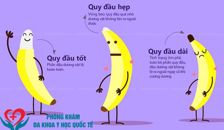 hình ảnh dài bao quy đầu