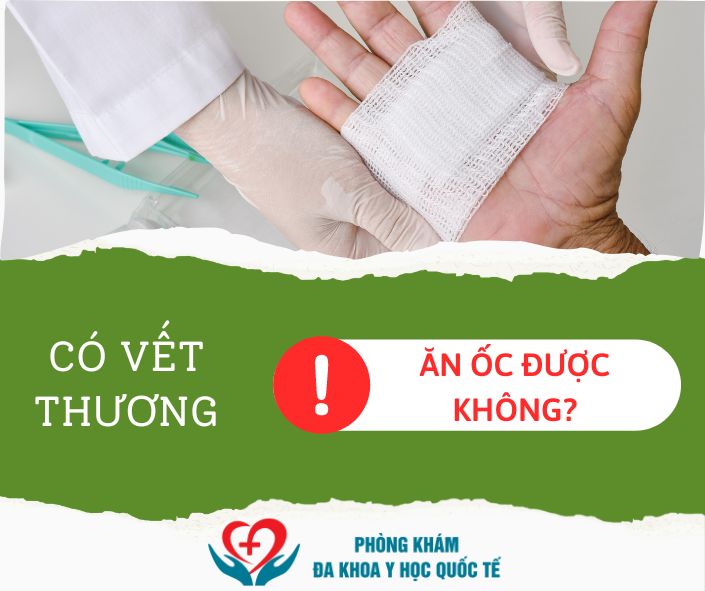 Có vết thương ăn ốc được không