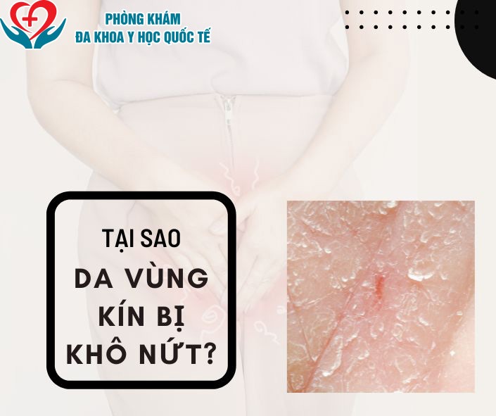 Tại sao da vùng kín bị khô nứt