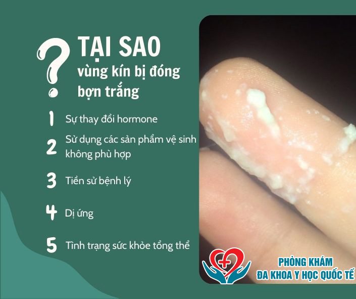 Tại sao vùng kín bị đóng bợn trắng?