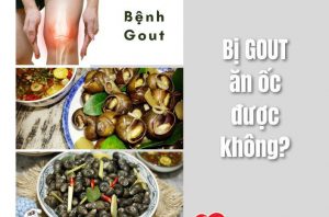 bi-gout-an-oc-duoc-khong