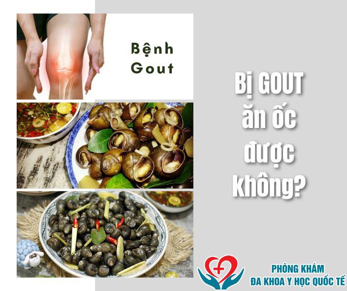 Bị gout ăn ốc được không?